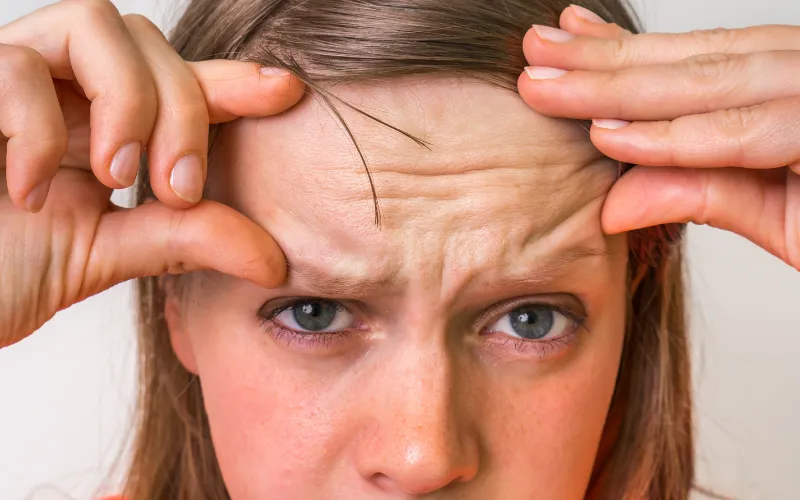 Elastin bị giảm theo thời gian?