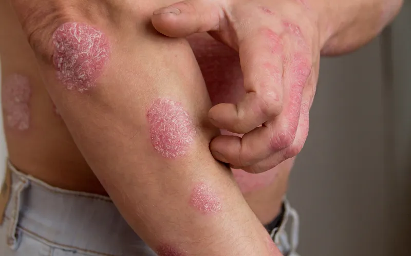 Lợi ích tiềm năng khác