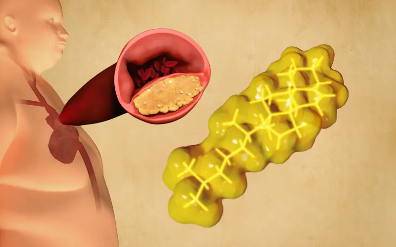Giảm cholesterol