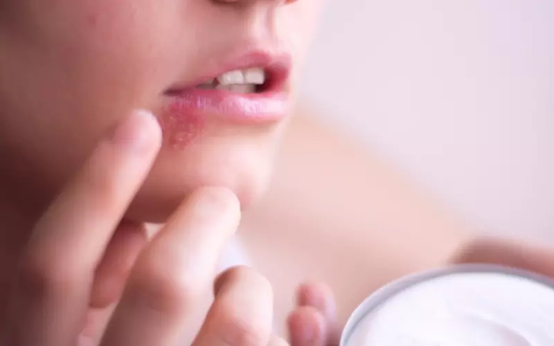 Giảm ngứa ở bệnh Herpes