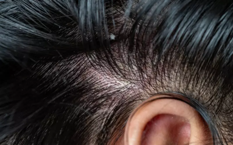 Loại da của mỗi người