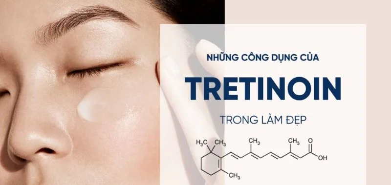 Tretinoin là gì?