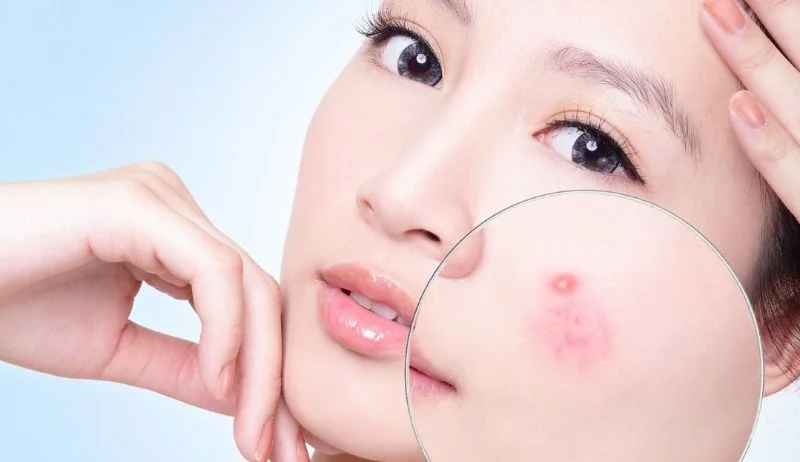 Hiệu quả trên da