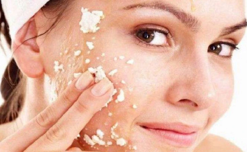 Dạng kỳ - Peeling Gel