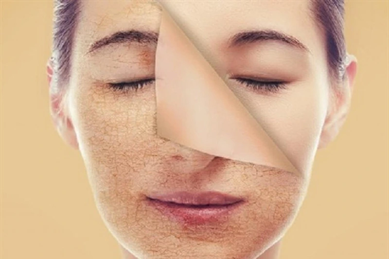 Nhược điểm