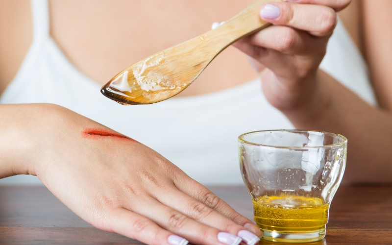 Mật ong Manuka hỗ trợ chữa lành vết thương