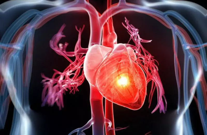 Đường tinh luyện gây nên bệnh tim mạch