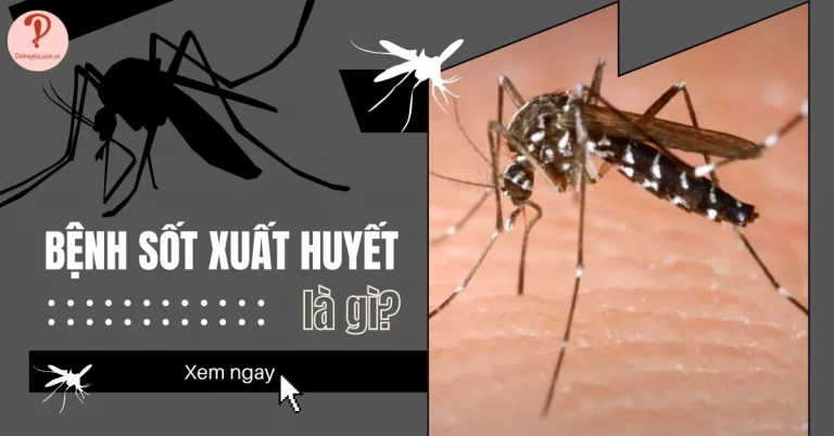 bệnh sốt xuất huyết